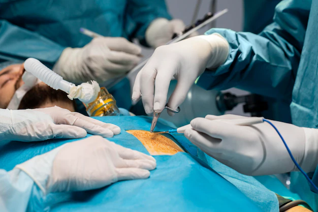 GENERAL LAPROSCOPIC SURGERIES IN BEL ROAD