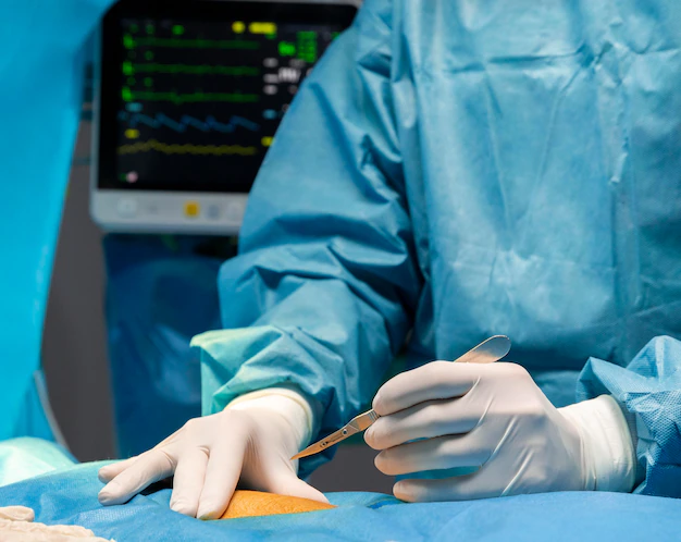 LAPAROSCOPIC SURGEON IN BEL ROAD